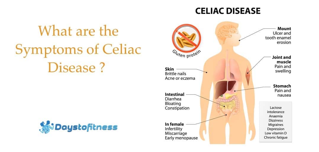 What are the Symptoms of Celiac Disease ? 